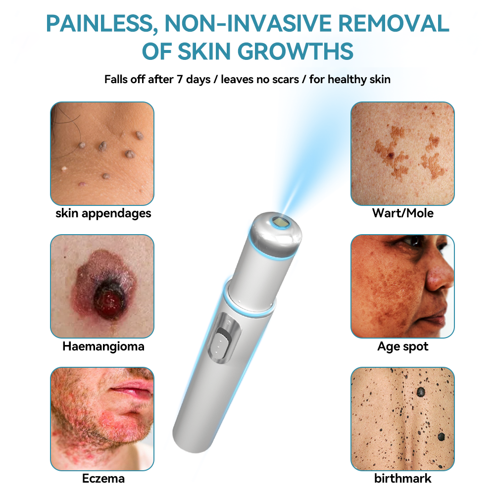 ๐๐๐ฌ๐ฌ๐๐๐ฆยฎ Medical-Grade Laser Pen ๐ (Powered by COโ laser technology โ effectively removes moles, warts, skin tags, pigmentation spots, and other skin imperfections)