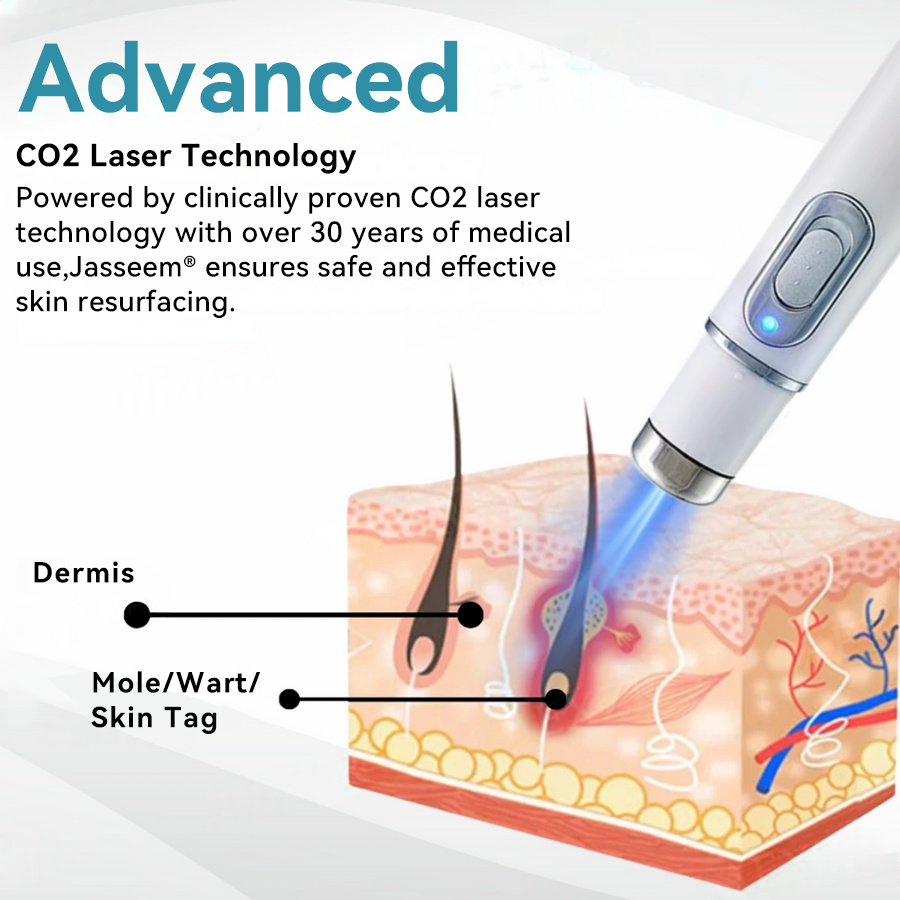 ๐๐๐ฌ๐ฌ๐๐๐ฆยฎ Medical-Grade Laser Pen ๐ (Powered by COโ laser technology โ effectively removes moles, warts, skin tags, pigmentation spots, and other skin imperfections)