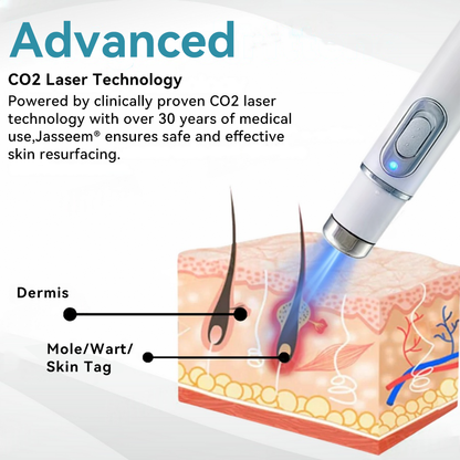 𝐉𝐚𝐬𝐬𝐞𝐞𝐦® Medical-Grade Laser Pen 🎉 (Powered by CO₂ laser technology – effectively removes moles, warts, skin tags, pigmentation spots, and other skin imperfections)